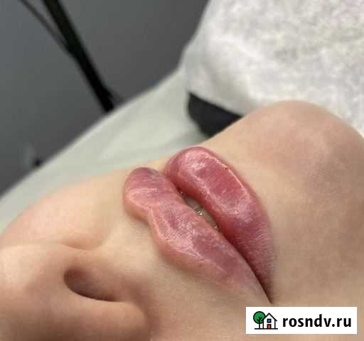 Косметология Омск - изображение 1