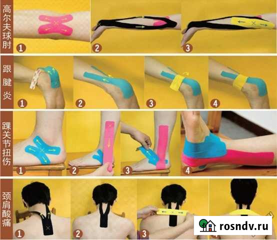 Kinesio Tape (кинезио тейпы) Красноярск - изображение 1