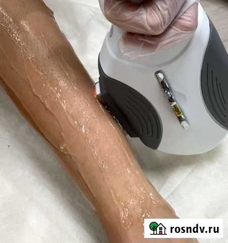 Салон лазерной эпиляции Казань - изображение 1