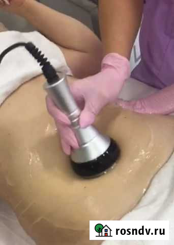 Кавитация и RF лифтинг, лазерный триполиз Саранск - изображение 1