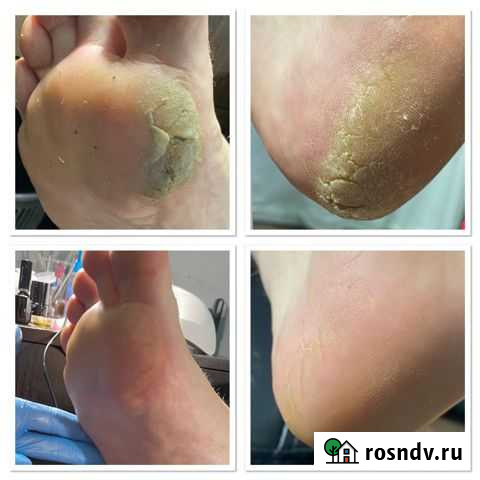 Педикюр Бабаево - изображение 1