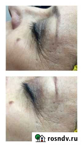 Косметолог-эстетист Челябинск - изображение 1