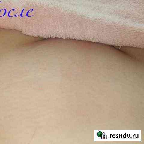 Мужская и женская эпиляция Пенза