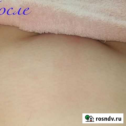 Мужская и женская эпиляция Пенза - изображение 1