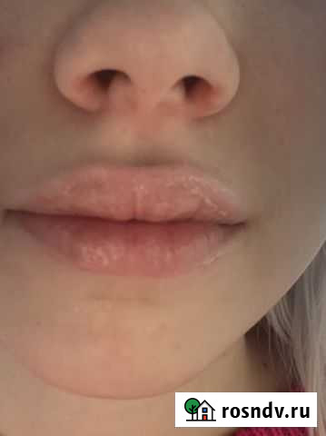 Косметология Белгород - изображение 1