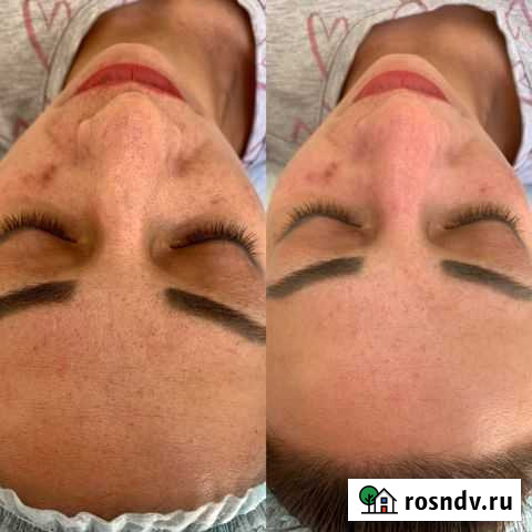 Косметолог Самара - изображение 1