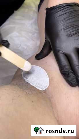 Эпиляция воском Саратов - изображение 1