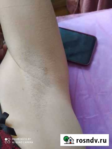 Восковая депиляция Ессентуки - изображение 1