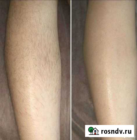 Депиляция. Сахар, воск. Девяткино. Мурино Мурино - изображение 1