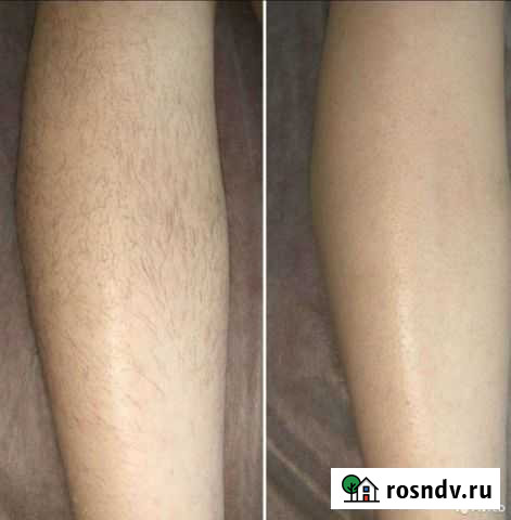Депиляция. Сахар, воск. Девяткино. Мурино Мурино - изображение 1