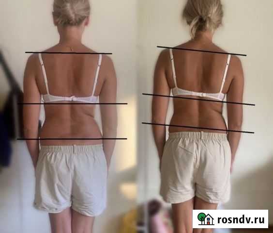 Кинезиолог Вышний Волочек - изображение 1