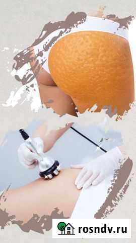 Вакуумный массаж, кавитация и RF-лица Старый Оскол - изображение 1