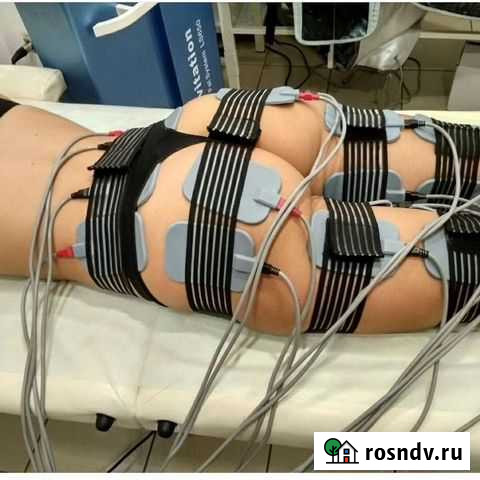 Миостимуляция Тамбов - изображение 1