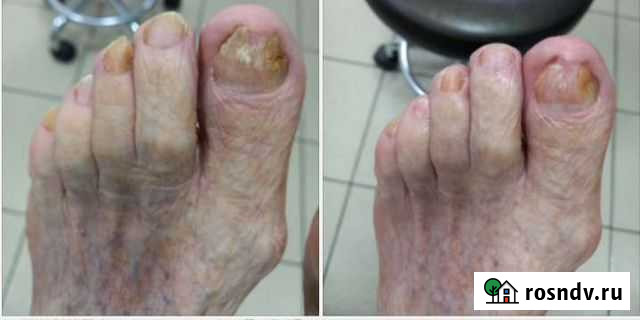 Педикюр Ейск - изображение 1