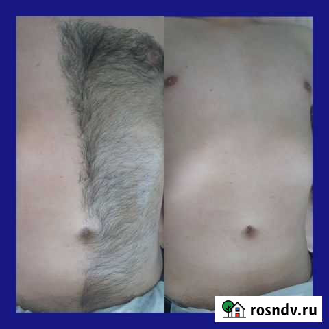 Мужской и Женский шугаринг Волгоград - изображение 1