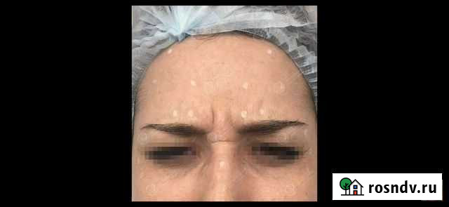 Косметолог Астрахань - изображение 1