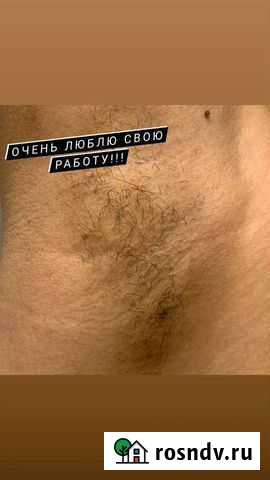 Электроэпиляция в Алексине Алексин - изображение 1