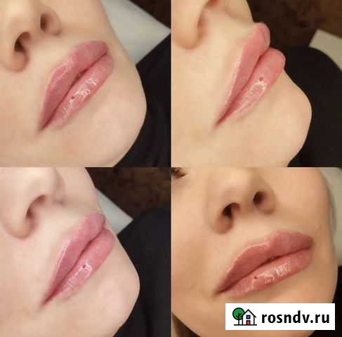 Косметолог Пермь - изображение 1