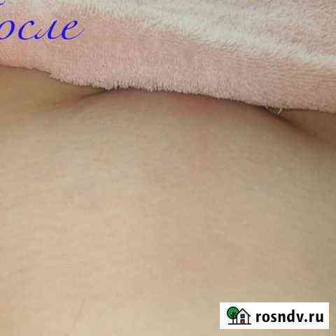 Мужская и женская эпиляция Пенза