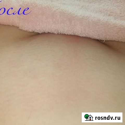 Мужская и женская эпиляция Пенза - изображение 1