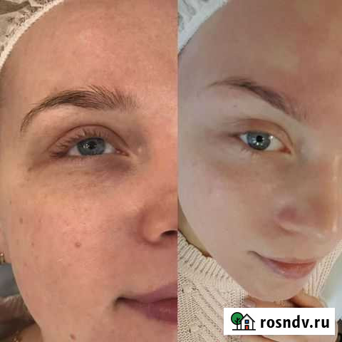 Услуги косметолога Элиста - изображение 1