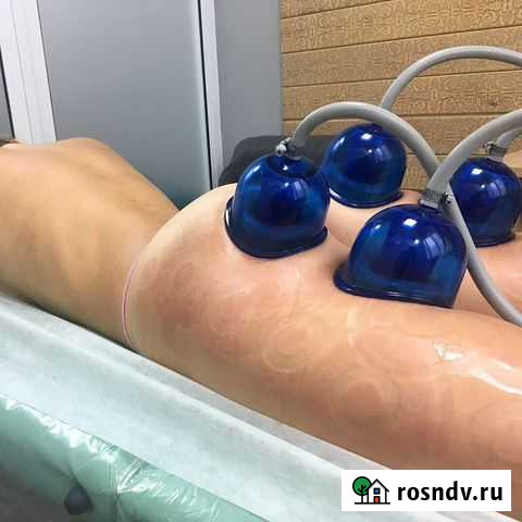 Массаж Starvac, РФ-лифтинг, миостимуляция Галатея Кострома - изображение 1