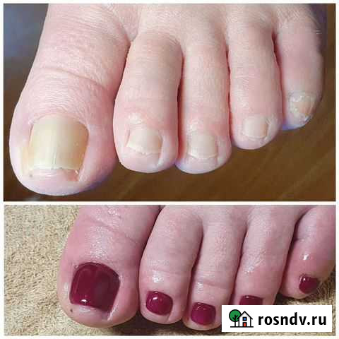 Педикюр Большое Буньково - изображение 1