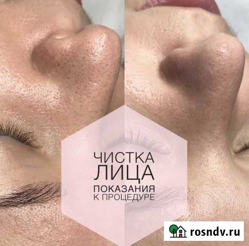 Чистка лица Белгород - изображение 1