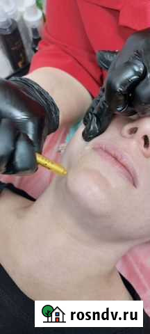 Биоревитализация без иглы Кемерово - изображение 1