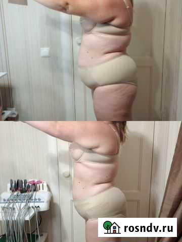 Массаж кавитация Череповец - изображение 1