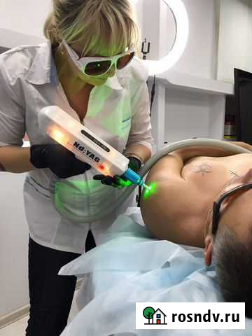 Удаление тату и татуажа лазером Череповец - изображение 1