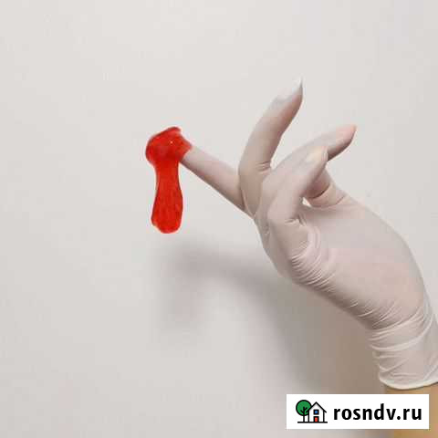 Депиляция Красноярск - изображение 1