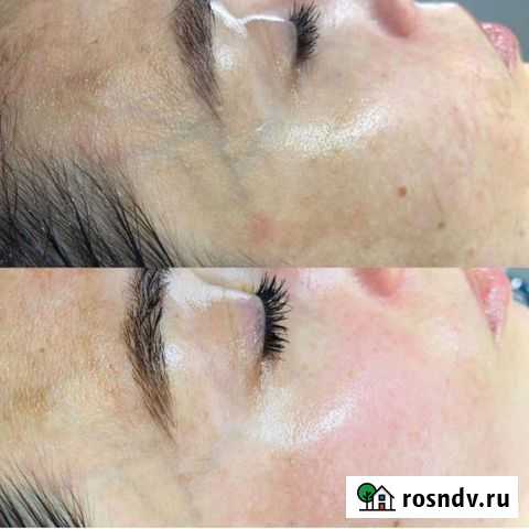 Косметолог- эстетист, массаж, чистка, уход Иркутск - изображение 1