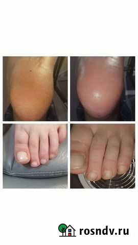 Педикюр smart педикюр Железногорск - изображение 1