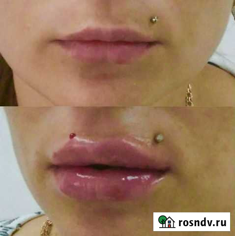 Губы Курган - изображение 1