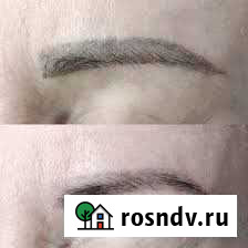 Удаление тату и перманентного макияжа Иваново - изображение 1