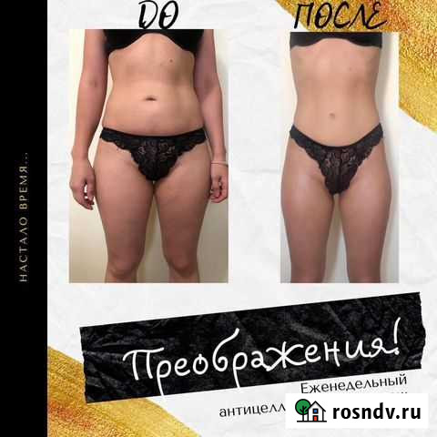 Массаж Калининград - изображение 1