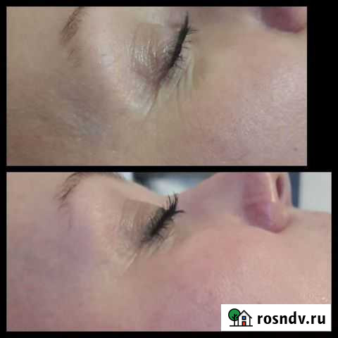 Скульптурный массаж лица Древлянка Петрозаводск - изображение 1