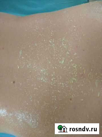 Массаж Саратов - изображение 1