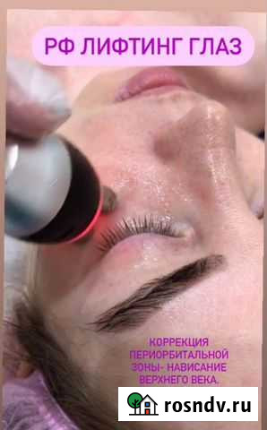 РФ лифтинг лица и тела Казань - изображение 1