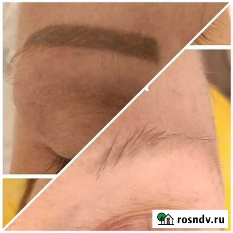 Удаление тату и татуажа Балашиха - изображение 1