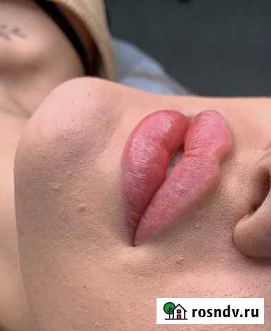 Омоложение Белгород - изображение 1