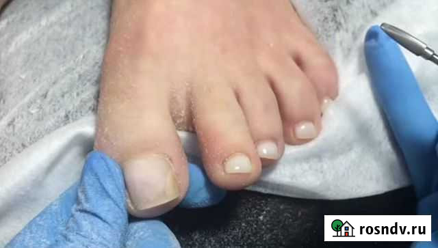 Практикующий мастер маникюра педикюра /подолог Всеволожск - изображение 1