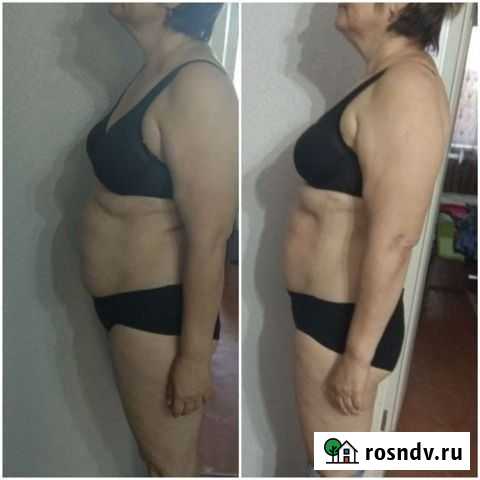 Бесплатная процедура Тюмень - изображение 1