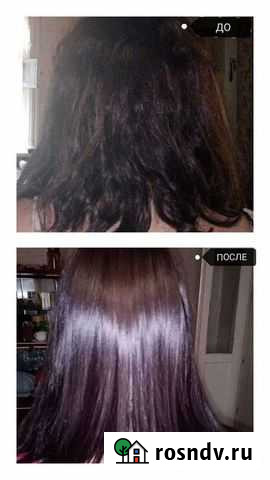 Нанопластика Саратов - изображение 1