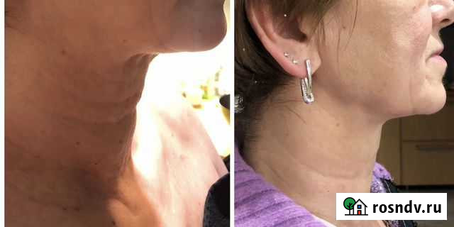 Массаж лица Казань - изображение 1