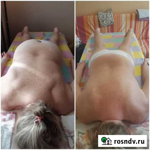 Массаж, лимфодренаж, антицелюлитный Белгород - изображение 1