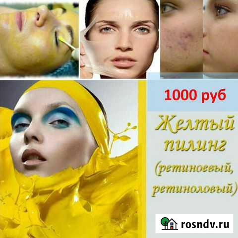 Пилинг ретиноевый (мощное обновление) Новокузнецк - изображение 1