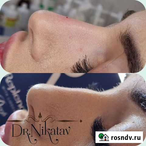 Услуги косметолога Сочи - изображение 1