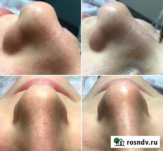 Косметолог на дому Ставрополь - изображение 1